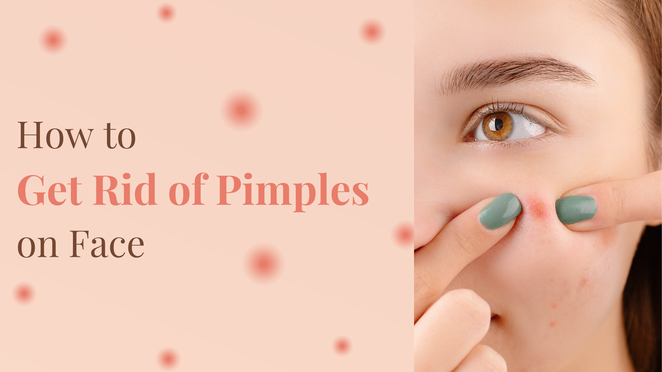 How-to-get-rid-of-pimples-on-face
