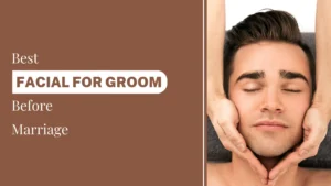 Best-Facial-For-Groom-Before-Marriage